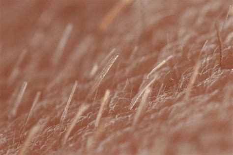 With alopecia aerata, hair loss begins with bald patches on the scalp which may develop in numbers. 3 signs of regrowth in alopecia areata | Lady Alopecia