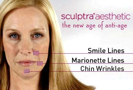 Who should take b12 shots. Sculptra - Sculptra Aesthetic | New Radiance Cosmetic ...