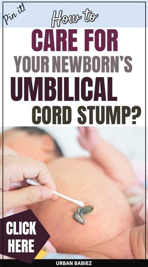 Doctors recommend giving only sponge baths until the stump has fallen off, and make sure to fold the front of the diaper down to keep it from rubbing on the umbilical cord stump. Pin by sukhomazova_nina on Baby in 2020 | Baby umbilical ...