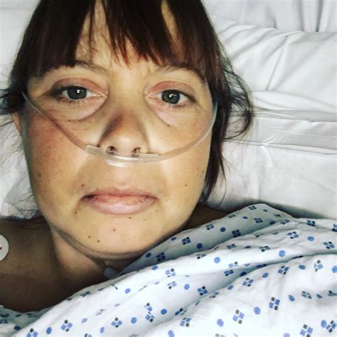 In most of europe, bowel cancer screening programmes start at the age of 50 because cases of the disease are much higher among this older age group. Woman, 30, had bowel cancer symptoms dismissed as 'women's ...