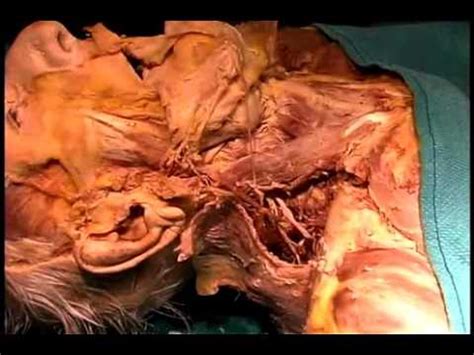 Maybe you would like to learn more about one of these? Human Anatomy Real Dissection 6 - YouTube