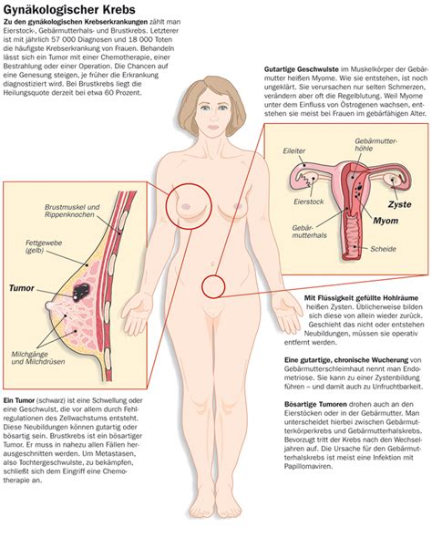 Auch eine schwangerschaft kann bei manchen frauen zu unspezifischen schmerzen im bei frauen in den wechseljahren kann eine gebärmutterabsenkung recht häufig ein grund für die. Schmerzen unter der rechten brust frau. Schmerzen unter ...