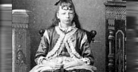 This woman josephine myrtle corbin has 4 leg. Kobieta zachodzi w ciążę, a lekarze są oszołomieni tym, co odkrywają. To niezwykle rzadkie ...