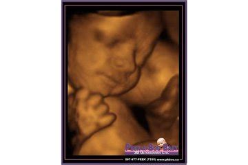 Peek a boo ultrasound, llc ei tegutse valdkondades uuringute, arenduse ja testimisteenused, meditsiinilaborid, remont muu. Peek-a-Boo Baby 3D Ultrasounds Ltd., Red Deer AB | Ourbis
