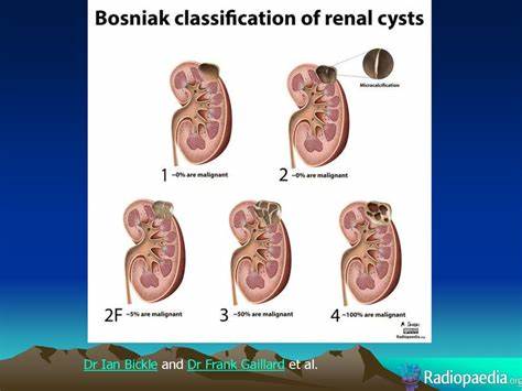 Кисты почек - презентация онлайн Картинка - Кисты почек - презентация онлайн