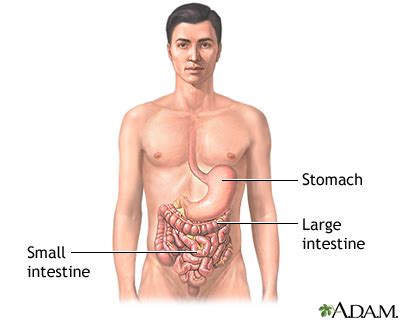 Viral gastroenteritis is present when a virus causes an infection of the stomach and intestine. CMV - gastroenteritis/colitis. Causes, symptoms, treatment ...