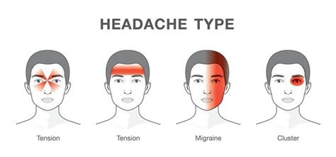 Perbedaan posisi sakit kepala dapat membedakan penyebab terjadinya nyeri. 15 CARA MENGURANGKAN SAKIT KEPALA TANPA UBAT | Sakit ...