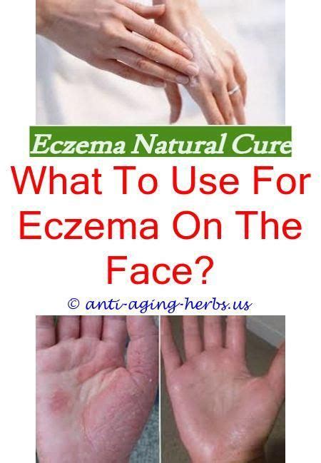 An emollient is essentially a layer or a barrier that sits on top of the skin to prevent moisture from escaping, in turn working to prevent dry, rough, flaky skin. eczema: Eczema Discoid Treatment