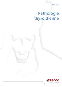 La palpation un nodule sur deux, signes fonctionnels de dysthyroidie, compression, gêne cervicale, douleur d 'apparition brutale. Nodule thyroïdien
