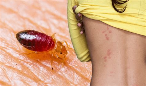Here's what you need to know about these bites, how to tell them apart from other bug bites, and the complications they can bring. Bed bug bites: What does a bed bug bite look like? Five ...