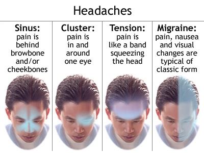 Nah setelah mengetahui jenis, tipe dan penyebab sakit kepala. Anak Sakit Kepala? Ini Punca Berlaku Migrain Dikalangan ...