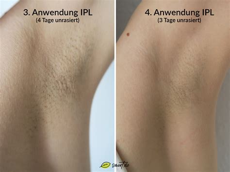 Ipl geräte werden für die haarentfernung immer beliebter und stellen eine willkommene alternative zu methoden wie dem waxing oder der epilation dar, denn sie arbeiten schneller und zuverlässiger. Für immer haarfrei: ️ IPL Geräte für Zuhause (2020) - Test ...