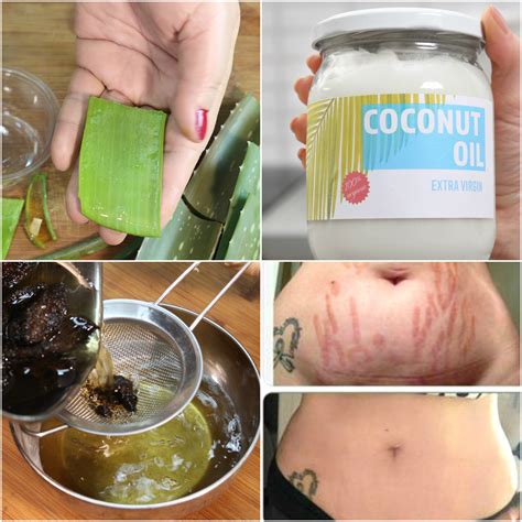 'i just thought of a new position that we could. Homemade Oil For Stretch Marks | Remove Them Permanently ...