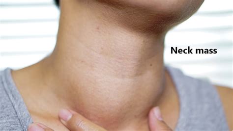 Транскрипция и произношение слова neck в британском и американском вариантах. Neck Mass: Causes, Symptoms, Risk Factors, Diagnosis, and ...