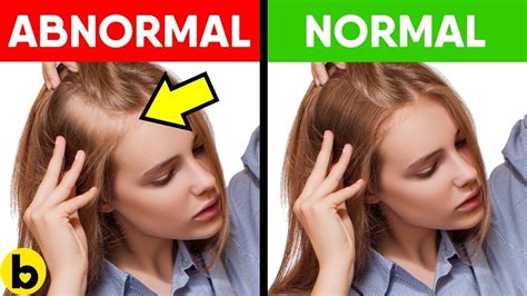 This Is What Your Hair Can Tell You About Your Health ...