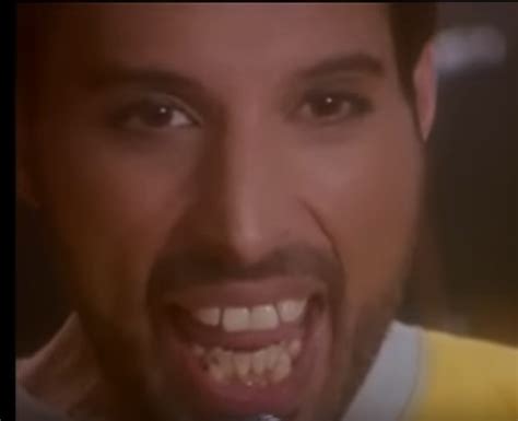 Freddie mercury's teeth are perhaps one of the most prominent teeth in the whole music history. Freddie Mercury Teeth - Image to u