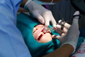 How much does treating gingivitis cost? Guide to Aftercare for Emergency Dental Extractions ...