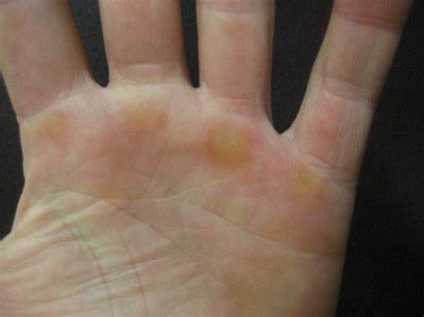 How to stop calluses on hands from the gym. Ultimate Guide to CrossFit Hand care and Protection ...