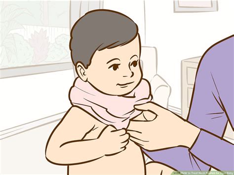 3 Ways To Treat Neck Rashes For Your Baby Wikihow