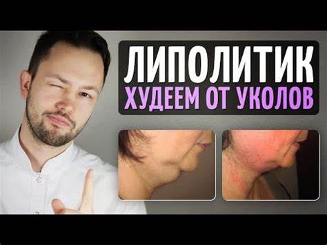 Можно похудеть от льняного семян