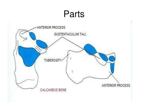 PPT - Fracture calcaneum PowerPoint Presentation, free ...