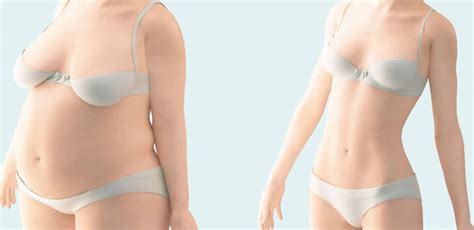 عمليات شفط الدهون في تركيا liposuction وكم سعر العملية وتجارب حقيقية 100% وهل يمكن اجراء العملية جراحياً أو من دون جراحة وما هي التقنيات؟ نصائح لكل شخص يريد ان يجري عملية شفط الدهون في تركيا liposuction يمكنه ان يجد في هذا المقال كل ما يخطر على ذهنه من. شفط الدهون بالفيزر: التكلفة والمميزات والعيوب ونتائج ...