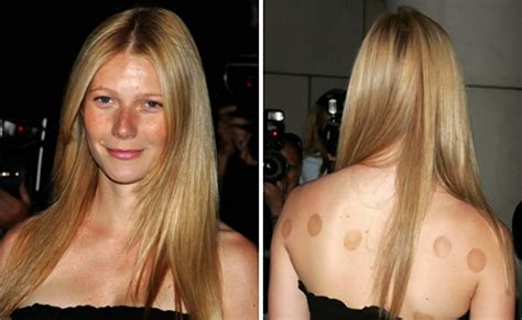 While cupping therapies using heat have the longest history in asian countries like china, japan and korea, a similar practice called wet cupping has also been used in the middle east for centuries. Five Points Massage | Avalon Blvd Massage | Asian Massage ...