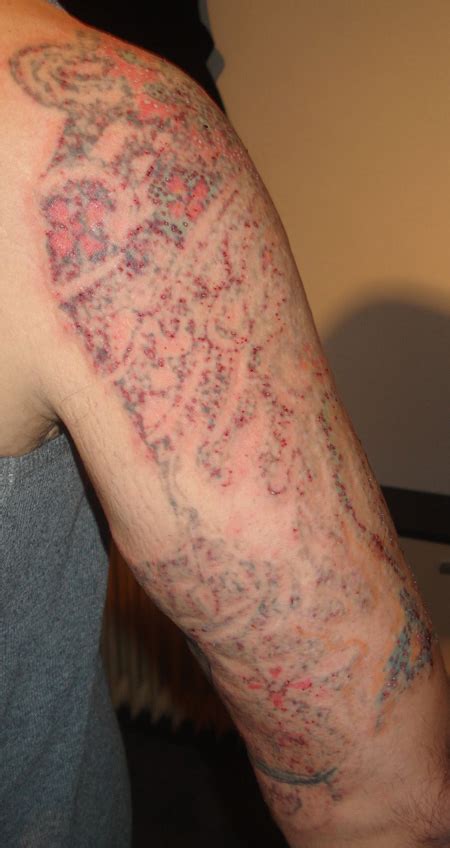 Attached are cool things i think i could use it for. Aktuelle Laserbehandlung | Tattoo-Bewertung.de