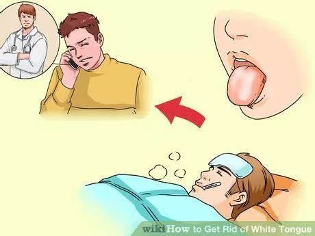 Clinical analysis is also done to exclude other related conditions. Get Rid of White Tongue | White tongue, How to get rid, Tongue