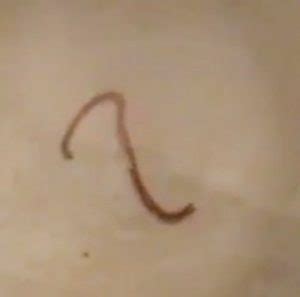 These worm toilets are a safe and effective alternative to costly sewage systems. Worm in Toilet Bowl Could be Ascaris Worm or Earthworm ...