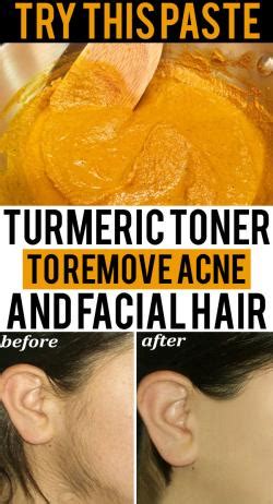 One has to necessarily undergo electrolysis hair removal treatment for permanent hair removal of facial trust me, i have used this remedy and it worked wonders for my skin. Turmeric Toner To Reduce Breakouts And Facial Hair - Skin ...