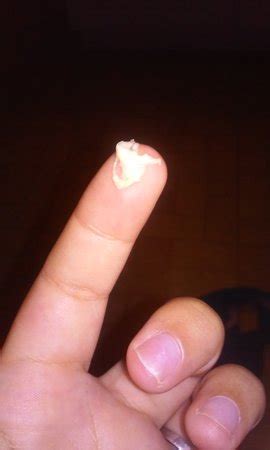 Your baby now has initial structures of what will become the nose and eyes in the future. Mucus plug?? **trigger photo** | BabyCenter