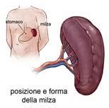 La splenomegalia è la milza ingrossata; Milza ingrossata nel bambino - MammaImperfetta