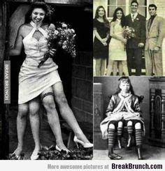 While at a glance one could plainly see four legs dangling. Josephine Myrtle Corbin (American, 1868-1928), was born a dipygus. This referred to the fact ...