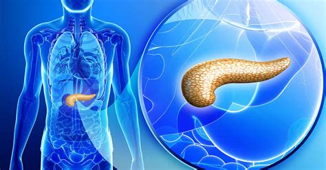 One of the first signs of pancreatic cancer can be jaundice, also known as icterus, which is the yellowing of the skin, eyes and mucus membranes due to too much bilirubin in the bloodstream. Pancreas/Pancreatitis | Great Lakes Gastroenterology