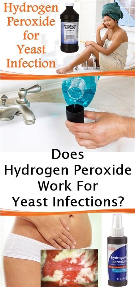 Dangers, tips, & precautions when dealing with baking soda use the result to bathe and wipe the baby's body gently. Hydrogen Peroxide for Yeast Infection | Yeast infection ...