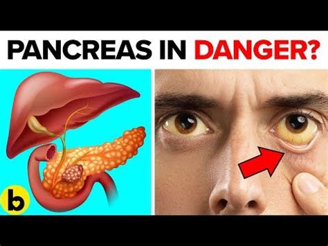 Some people with pancreatic cancer have a sense of early fullness with meals (satiety) or an uncomfortable swelling in the abdomen. 7 Warning Signs Your Pancreas Is In Trouble - YouTube in ...