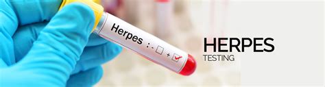 Herpes simplex virus (hsv) is a viral infection that affects the skin causing blisters that ulcerate infection is determined on blood testing based on presence of antibodies to the virus, which are. Herpes Test London | Herpes Testing | STDCheck Clinic