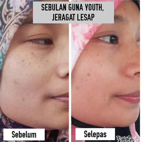 .jeragat iema makin kurang sebab ni. iema memang pelik dengan sesetengah produk yang claim bole hilangkan jeragat dalam masa seminggu/ sebulan.ohemgiiii. Krim Jeragat Lulus KKM Dan Berkesan | Vitamin Cerdik by ...