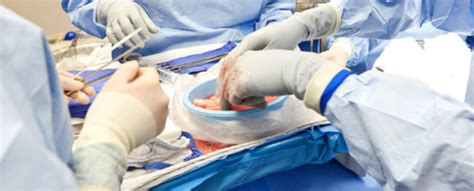 Auch mit blick auf die akzeptanz. Organspende: Ethikrat diskutiert Verteilung - DocCheck