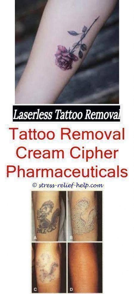 To remove a small tattoo with the easiest colors to remove, the price range is between usd 200 to usd 400. low cost tattoo removal can a tattoo be removed the day ...