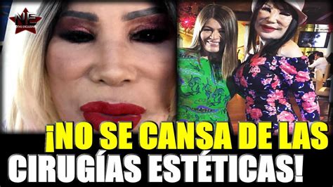 Conforme el tiempo pasó, lyn may llamó más la atención por haberse sometido a un tratamiento de inyecciones que le deformó el rostro, y que esta peculiar mujer, quiso compartir con sus más 106mil seguidores, una serie de fotografías donde presume su belleza antes de las múltiples cirugías a las. Lyn May se someterá a tres cirugías estéticas para mejorar ...