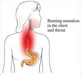 Continuous or sustained damage in the throat due to smoking leads to more severe health issues. Acid Reflux