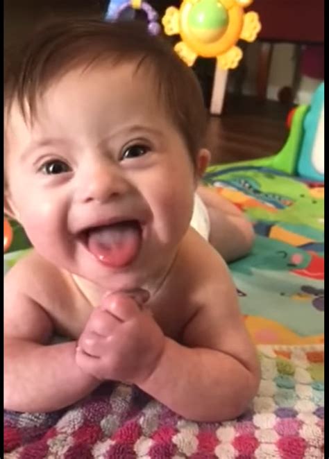 تدريب للمساعدة على التقلب مع الطفلة شيخة و اسامة مدبولي. Viral video of adopted baby with Down syndrome highlights ...