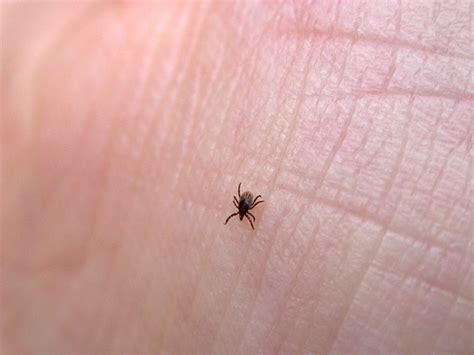 How to get rid fungus gnats. Know the signs of Lyme disease | Edward-Elmhurst Health