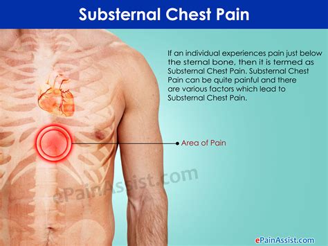 If the lump does not go away when. Quotes about Chest pain (25 quotes)