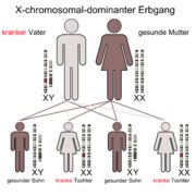 Norrie syndrom in anderen sprachen: Erbleiden