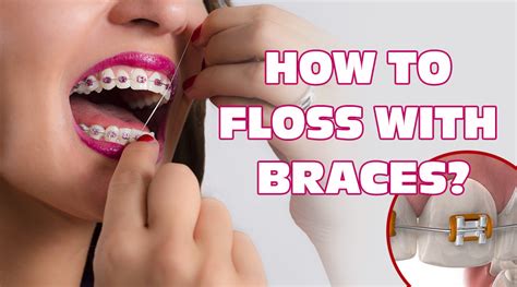 How to floss with braces behind teeth. Orthodontics: The Right Way To Floss Your Teeth With Braces