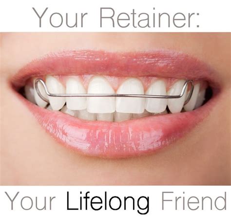 Fixed / permanent retainers —. How Long Do I Have To Wear Retainers At Night - Bmoshow Blog