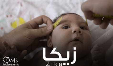 وجد هذا الفيروس لأول مرة في أفريقيا في أربعينات القرن الماضي، وانتشر فيما بعد حول العالم. فيروس زيكا وكل ما يجب عليك معرفته - كل يوم معلومة طبية